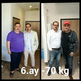 VORHER NACHER BILDER DER PATIENTEN