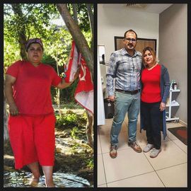 VORHER NACHER BILDER DER PATIENTEN