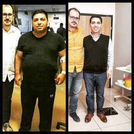 VORHER NACHER BILDER DER PATIENTEN