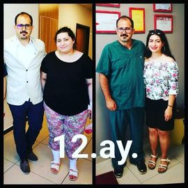 VORHER NACHER BILDER DER PATIENTEN