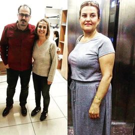 VORHER NACHER BILDER DER PATIENTEN