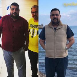 VORHER NACHER BILDER DER PATIENTEN