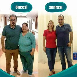 VORHER NACHER BILDER DER PATIENTEN