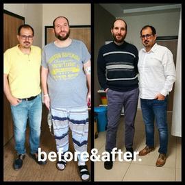 VORHER NACHER BILDER DER PATIENTEN