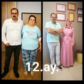 VORHER NACHER BILDER DER PATIENTEN