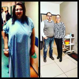 VORHER NACHER BILDER DER PATIENTEN