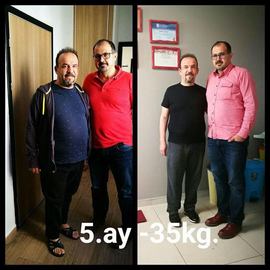 VORHER NACHER BILDER DER PATIENTEN