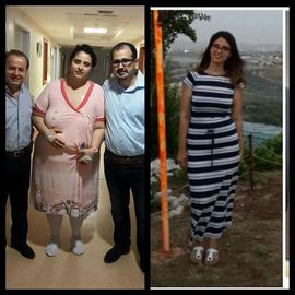 VORHER NACHER BILDER DER PATIENTEN