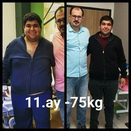 VORHER NACHER BILDER DER PATIENTEN