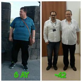 VORHER NACHER BILDER DER PATIENTEN