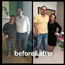 VORHER NACHER BILDER DER PATIENTEN