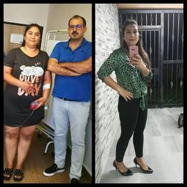 VORHER NACHER BILDER DER PATIENTEN