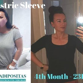 VORHER NACHER BILDER DER PATIENTEN