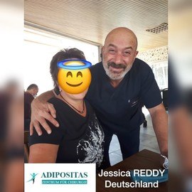 VORHER NACHER BILDER DER PATIENTEN