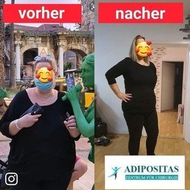 VORHER NACHER BILDER DER PATIENTEN