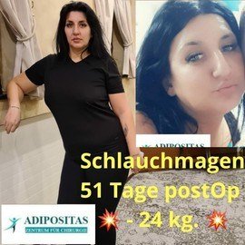 VORHER NACHER BILDER DER PATIENTEN