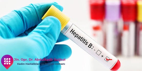 Hepatit B