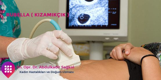 Rubella ( Kızamıkçık )