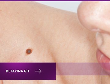 lazerle_ben_aldırma_yorumları_bursa