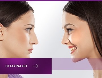 burun_estetiği_yorumları_bursa