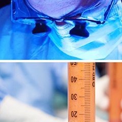 "Bugün aynı seansta göz kapağı estetiği ve yağ enjeksiyonu gerçekleştirdik. Yağ dolgularının en önemli avantajı kişinin kendi dokularının kullanılmasıdır. Bundan dolayı hem alerjik reaksiyon riski bulunmaz hem de..." instagram.com/dralitufansoydan