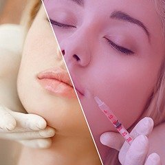 Hastalarımın sıkça sorduğu sorulardan biri kendilerinin botox mu yoksa dolguya mı ihtiyacı olduğu...DEVAMI