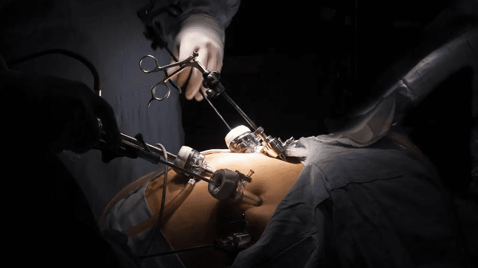 de derivación gástrica