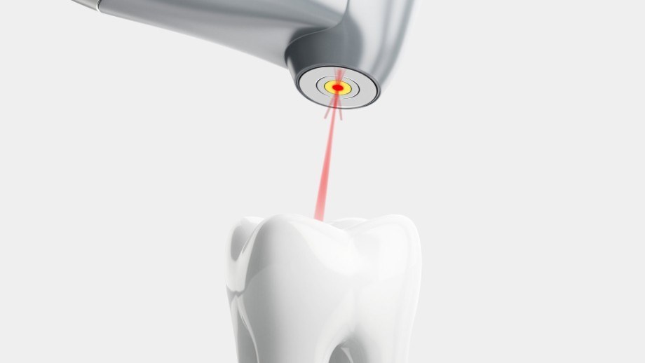 laser assisted dentistry