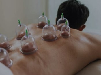 Hacamatın Faydaları: Geleneksel Tıbbın Etkili Şifa Yöntemi