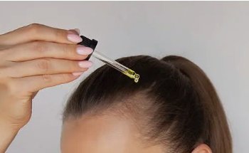 Saç Mezoterapisi Nedir?