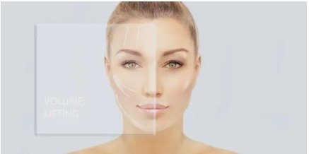 Sıvı Yüz Germe Nedir?