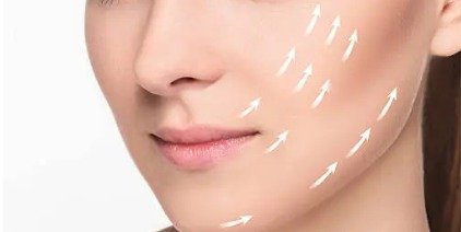 Sıvı Yüz Germe (Liquid Facelift) Nedir?