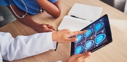 Nöroloji Doktoru Neye Bakar