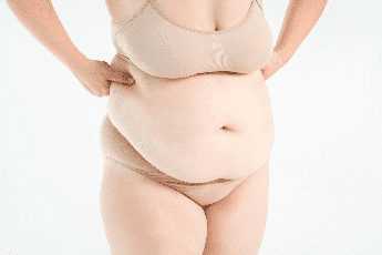 formedi Fleur de lis abdominoplasty