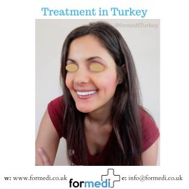 formedi Turkey