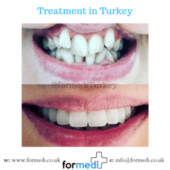 clinic Turkey dental