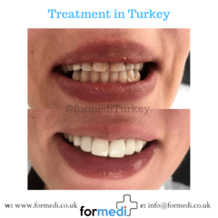 clinic Turkey dental