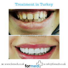 clinic Turkey dental