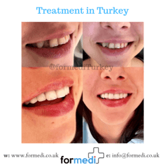clinic Turkey dental