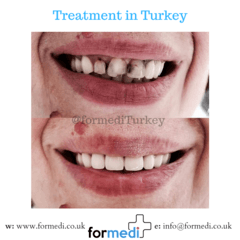 clinic Turkey dental