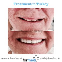 clinic Turkey dental