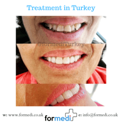 clinic Turkey dental