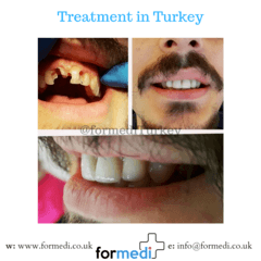 clinic Turkey dental