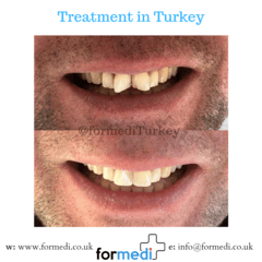 clinic Turkey dental