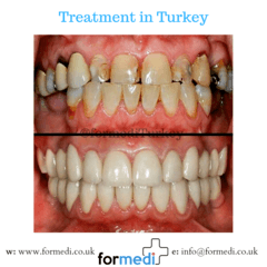 clinic Turkey dental