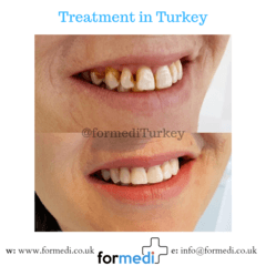 clinic Turkey dental