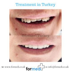 clinic Turkey dental