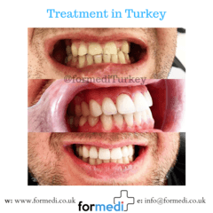 clinic Turkey dental