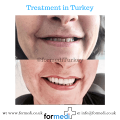 clinic Turkey dental