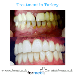 clinic Turkey dental